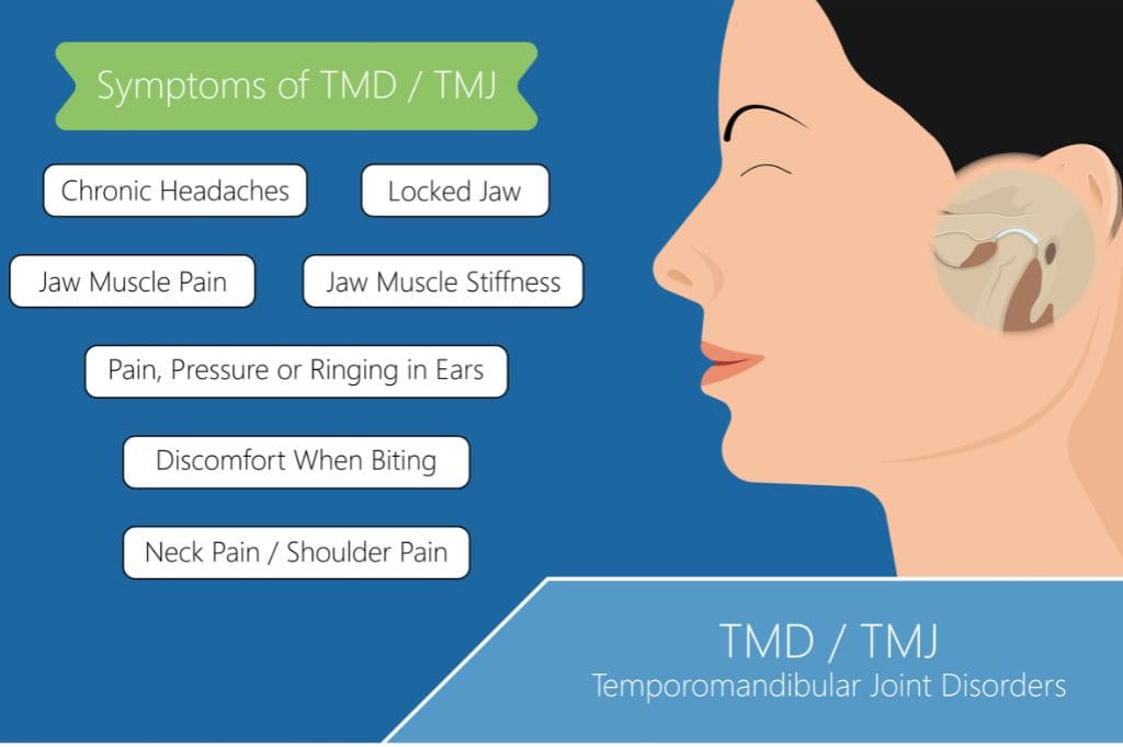 diagram of TMD/TMJ symptoms