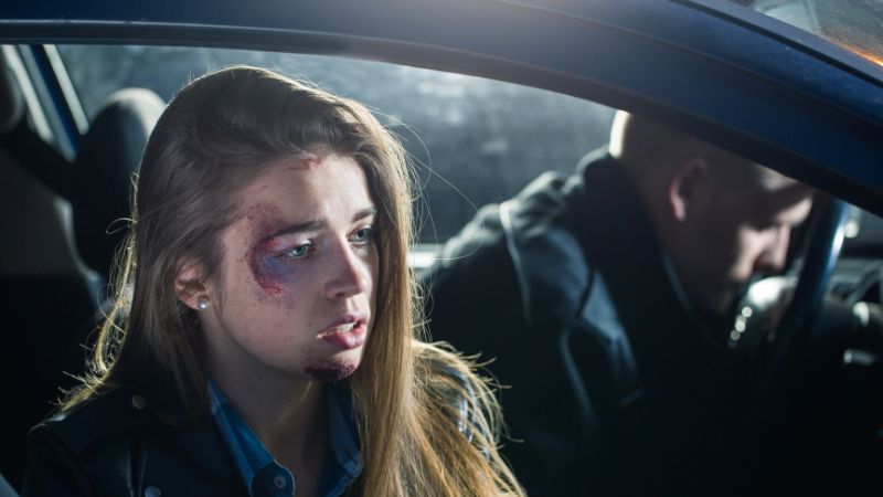 female sitting in a passenger seat with injuries